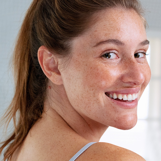 SVR lūpų balzamas stipriai sausėjančioms lūpoms TOPIALYSE LEVRES, 4 g