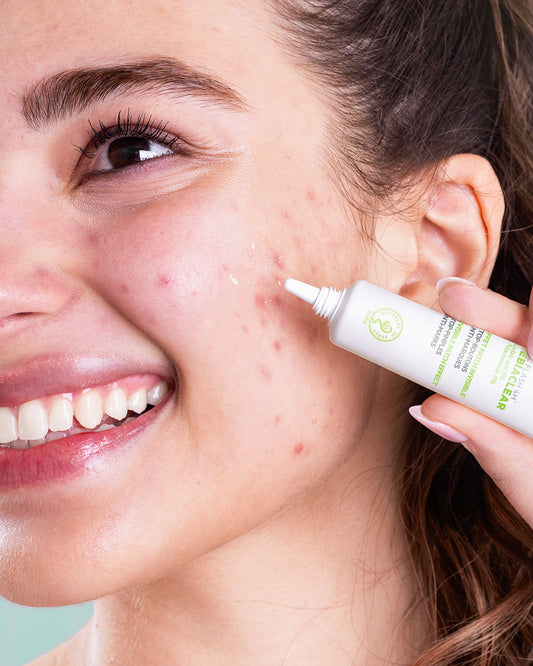 SVR lokalus gelis probleminėms zonoms SEBIACLEAR GEL FLASH 4H, 15 ml