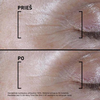 FILORGA veido serumas brandžiai odai su mimikos raukšlėmis TIME-FILLER 5XP SHOT, 15 ml